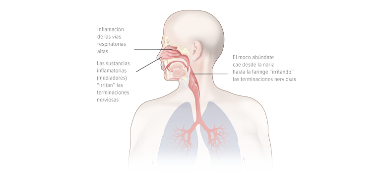 Factores que desencadenan la tos en las infecciones de las vías respiratorias superiores - Apoteca Natura