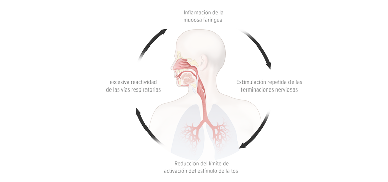 Círculo vicioso que facilita la persistencia de la tos - Apoteca Natura