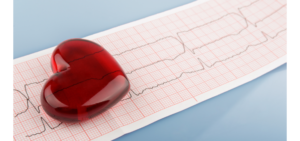 Consecuencias negativas del insomnio en el sistema cardiovasculares - Apoteca Natura