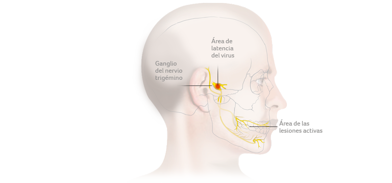 ¿Por qué el virus herpes simple de tipo 1 causa infecciones recurrentes? - Apoteca Natura