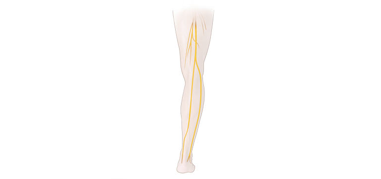 Neuropatía diabética - Apoteca Natura