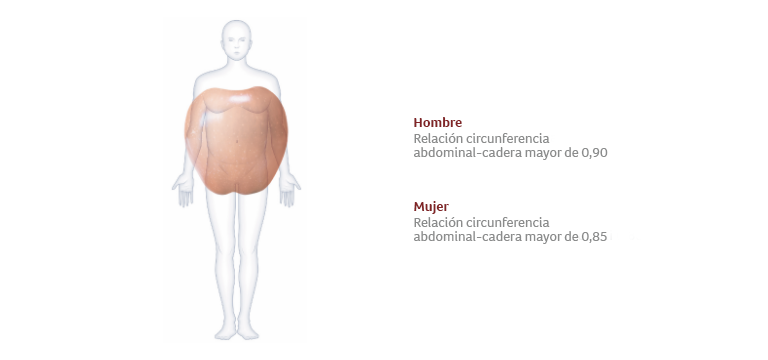 obesidad androide - Apoteca Natura