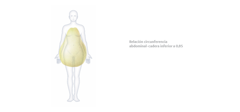 Obesidad ginoide - Apoteca Natura