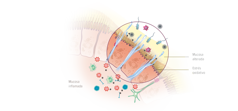 Alteración de la barrera mucosa intestinal - Apoteca Natura